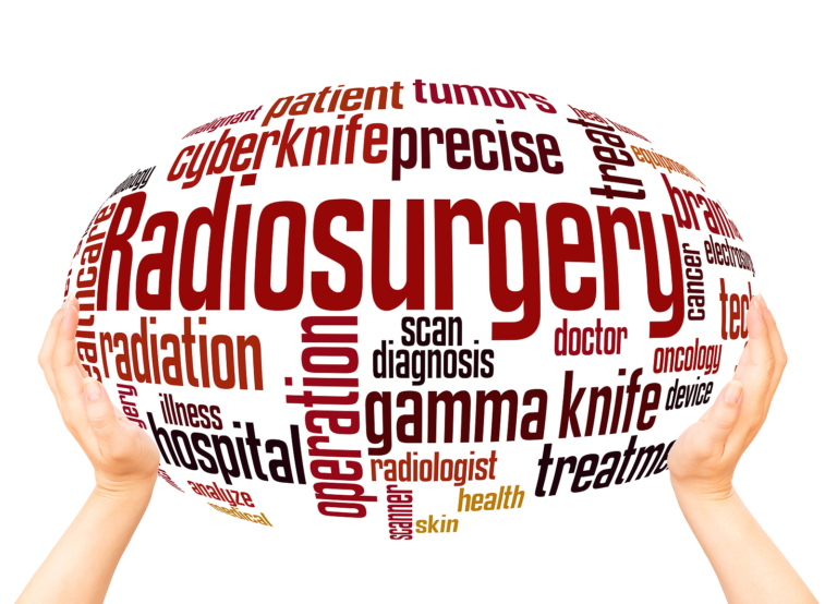 Gamma knife surgery - Radiosurgery word cloud