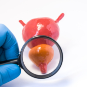 Strahlentherapiezentrum – Untersuchung des Prostata-Fotokonzepts durch einen Urologen