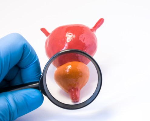 Strahlentherapiezentrum – Untersuchung des Prostata-Fotokonzepts durch einen Urologen