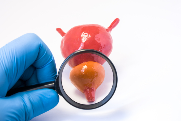 Radiotherapy Centre - Examination by doctor urologist of prostate gland photo concept