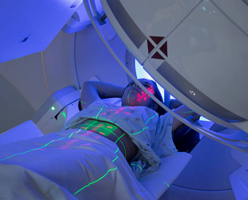 radiotherapy centre - radiotherapy