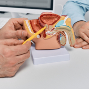 Radiotherapy Centre - Doctor consulting man patient with suspected prostate cancer