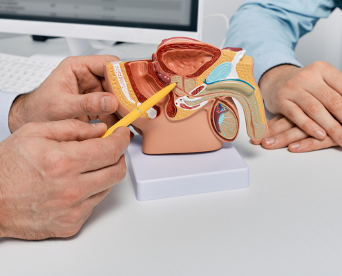 Radiotherapy Centre - Doctor consulting man patient with suspected prostate cancer