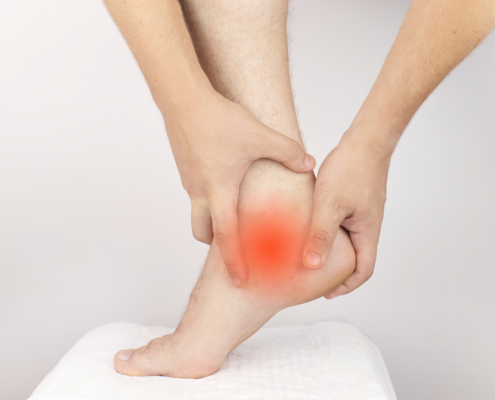 Types of radiotherapy - Achilles tendon sprain