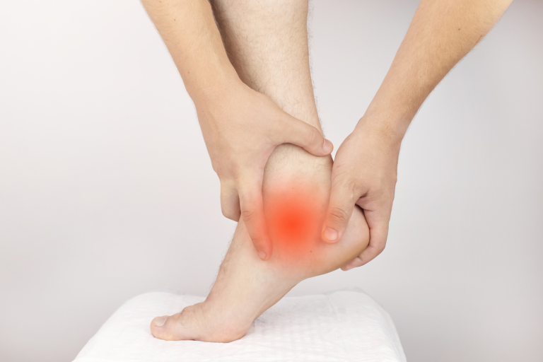 Types of radiotherapy - Achilles tendon sprain