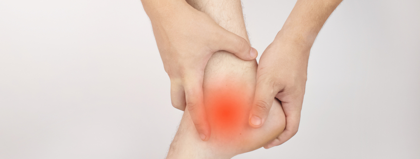 Types of radiotherapy - Achilles tendon sprain