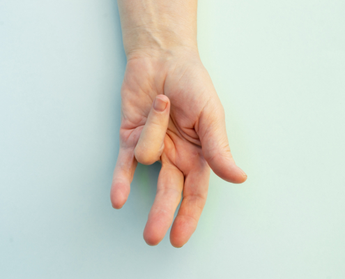 radiotherapy centre in Austria - Dupuytren's contracture disease