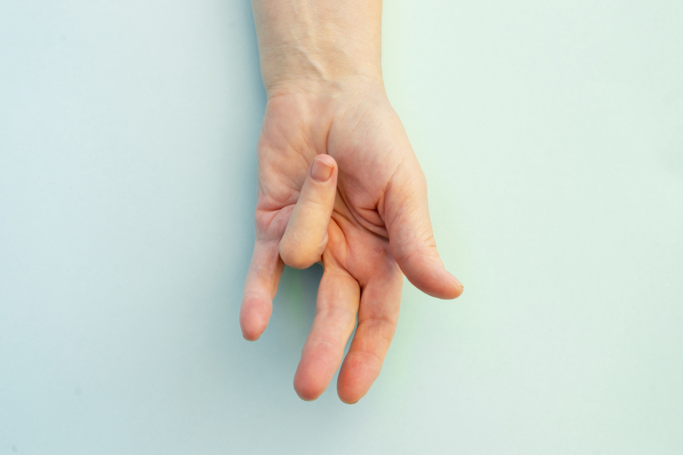 radiotherapy centre in Austria - Dupuytren's contracture disease