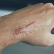 Strahlentherapiezentrum